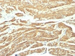 Caldesmon/CALD1 Antibody (SPM168), Novus Biologicals 0.2mg; Unlabeled:Antibodies,